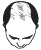 Best hair transplant near me