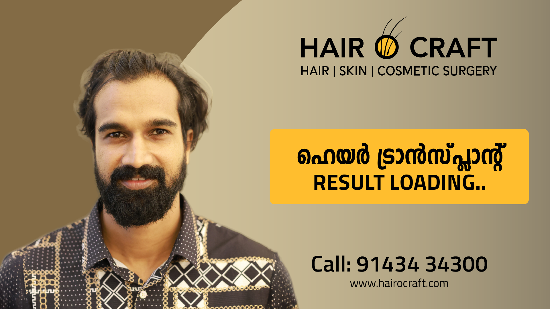 Man showcasing natural-looking hair transplant results at Hair O Craft clinic, highlighting improved hair density, restored hairline, and increased confidence after treatment.