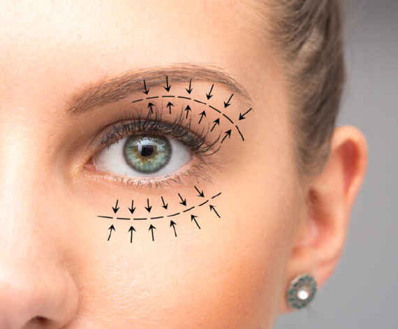 Types of Blepharoplasty