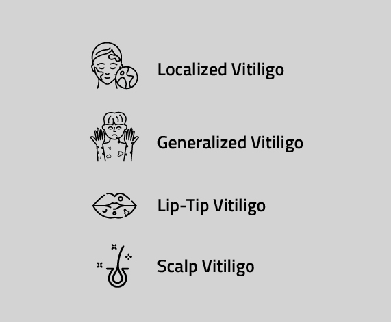 Types of Vitiligo