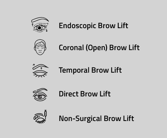 Types of Brow Lifts