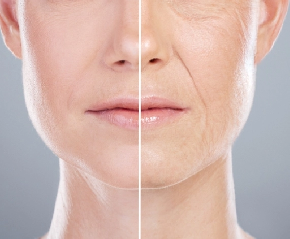 Smooth Out Wrinkles and Turn Back the Clock with Wrinkles Treatment at Hair O Craft 