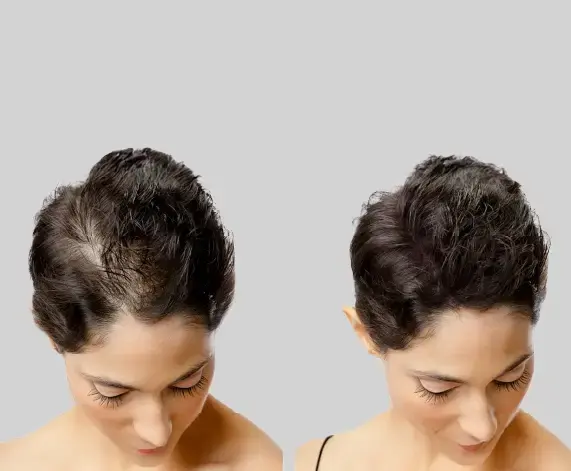 Micro Pigmentation for women