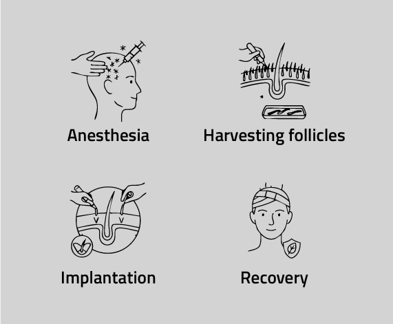 The Sapphire Hair Transplant Procedure