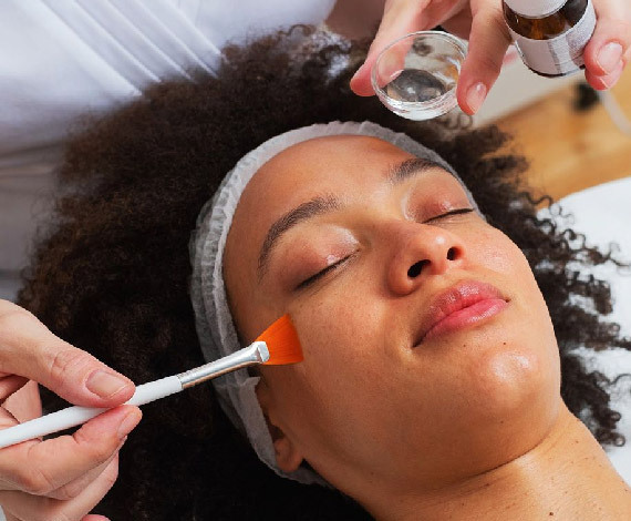 Benefits of Chemical Peel