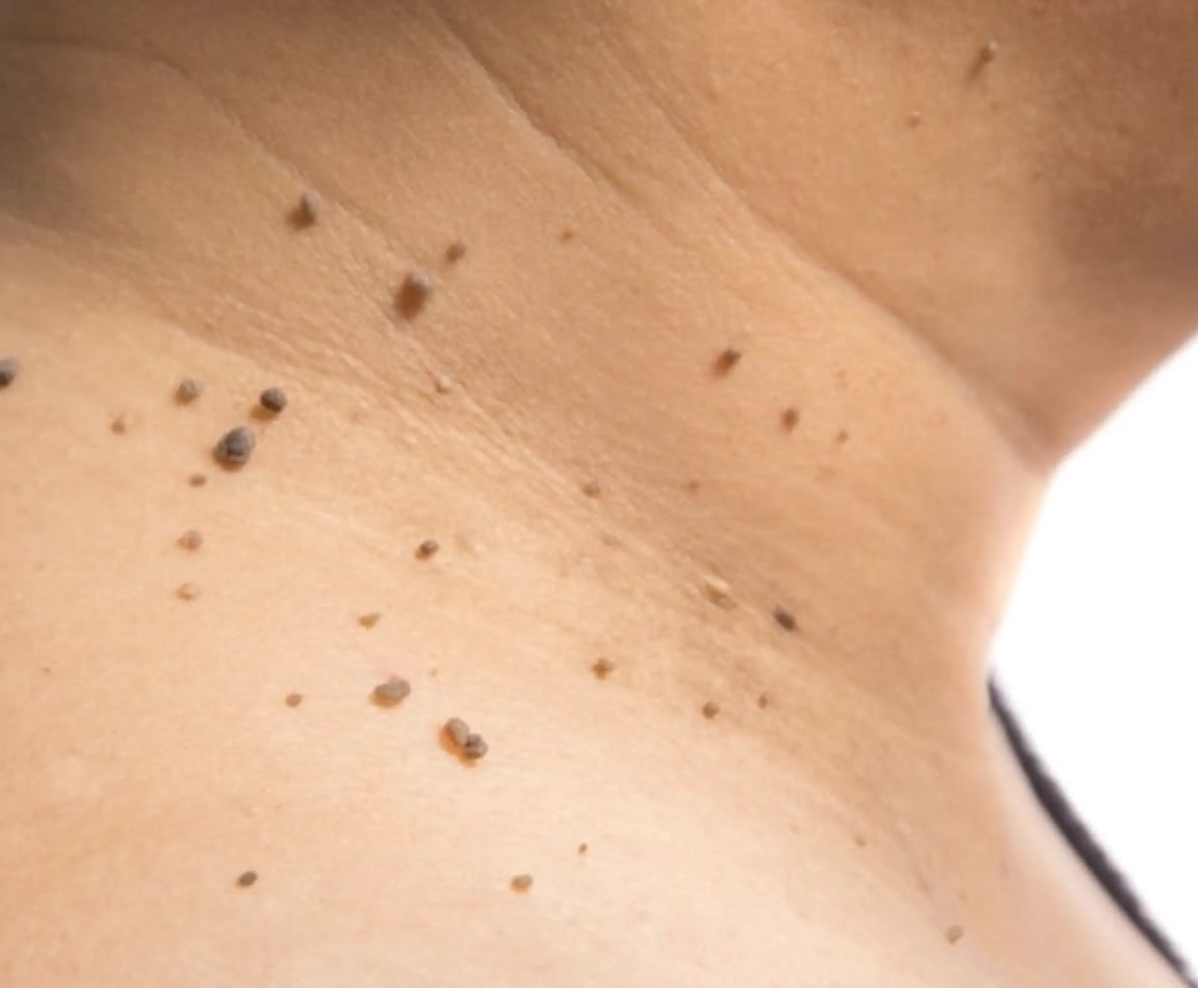 Aftercare and Safety