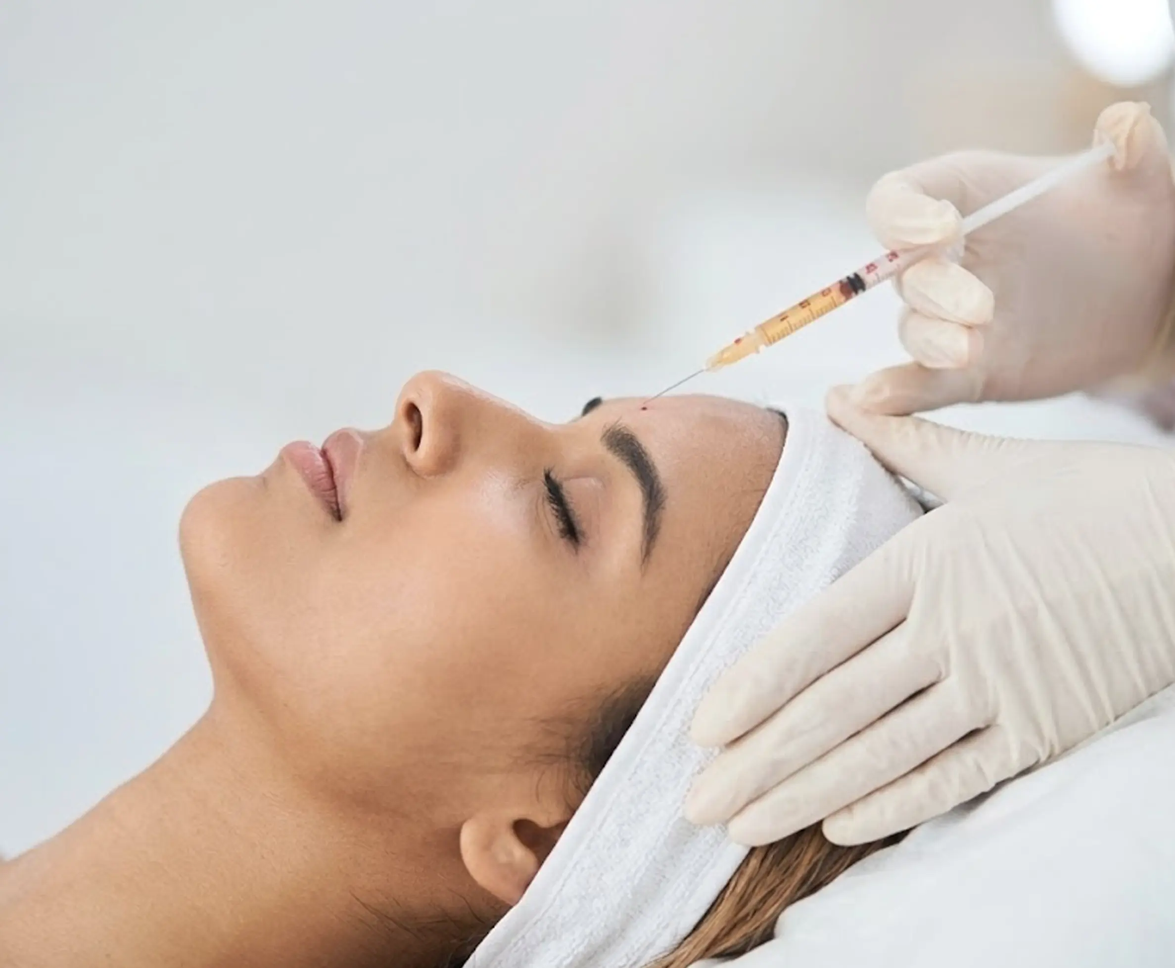Benefits of Face PRP Treatment