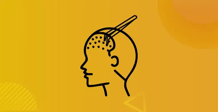 Long Hair Transplant