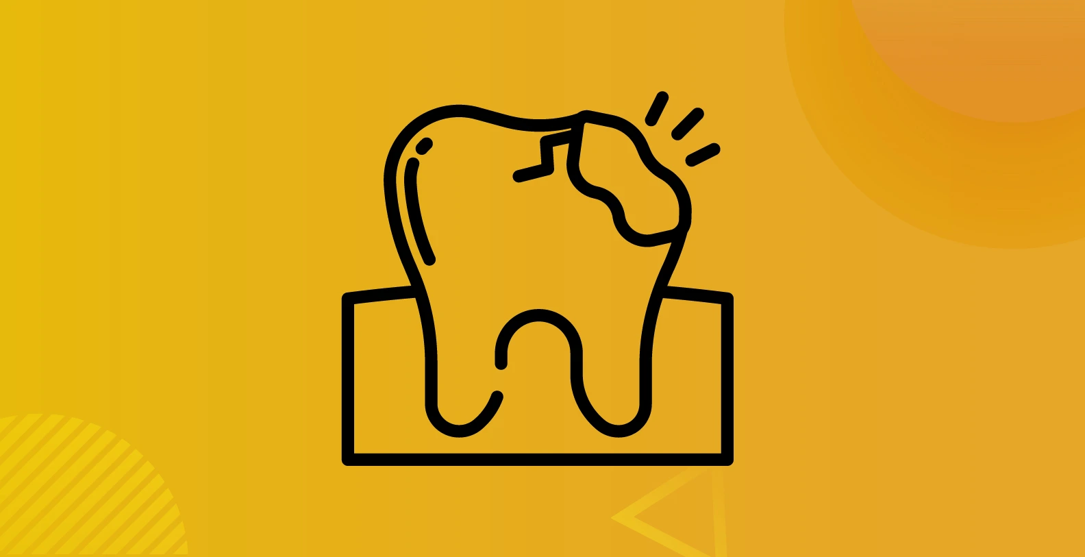  Tooth Decay and Cavity Treatment